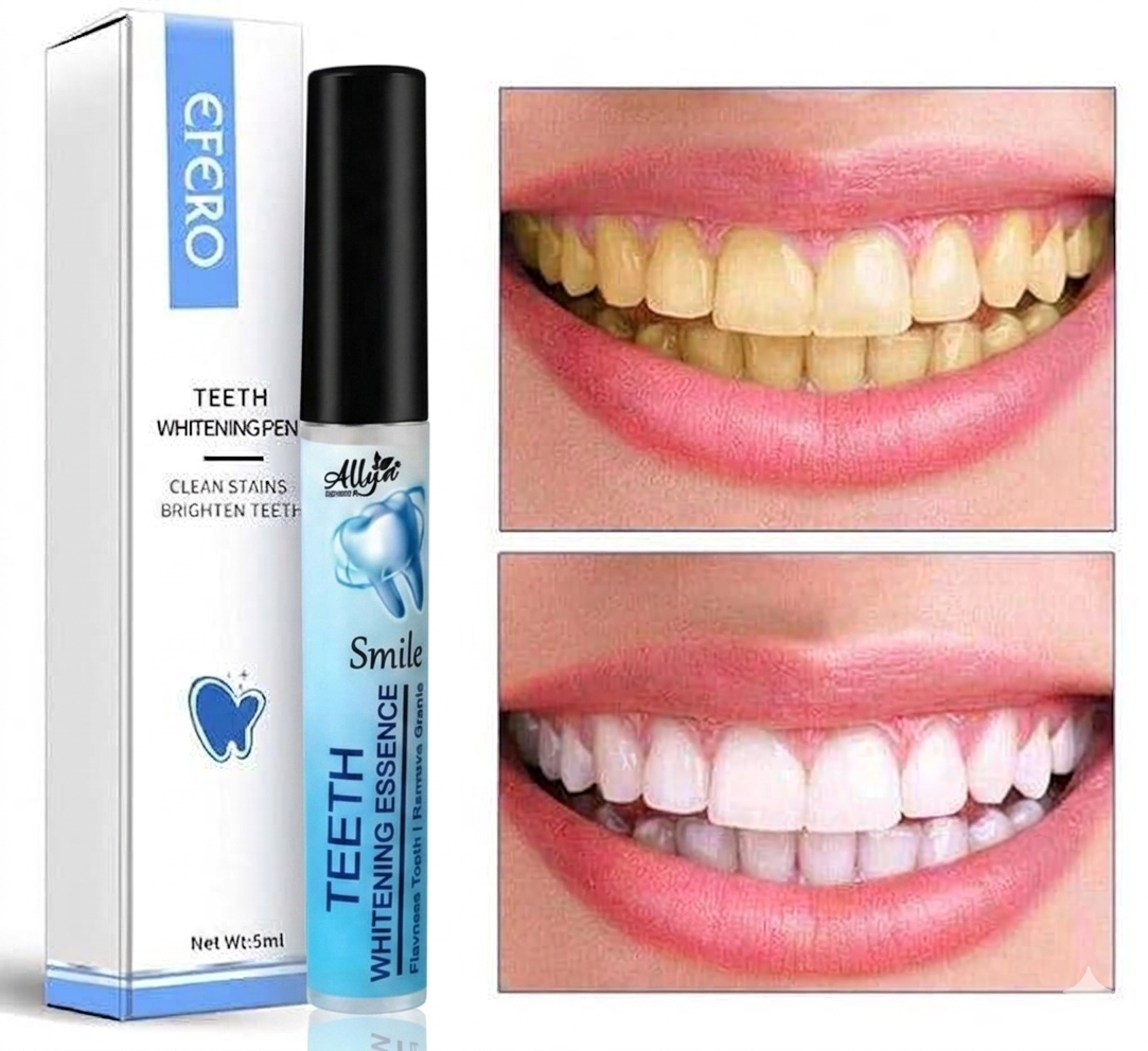 Teeth Whitening Gel Pen