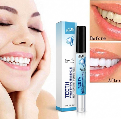 Teeth Whitening Gel Pen